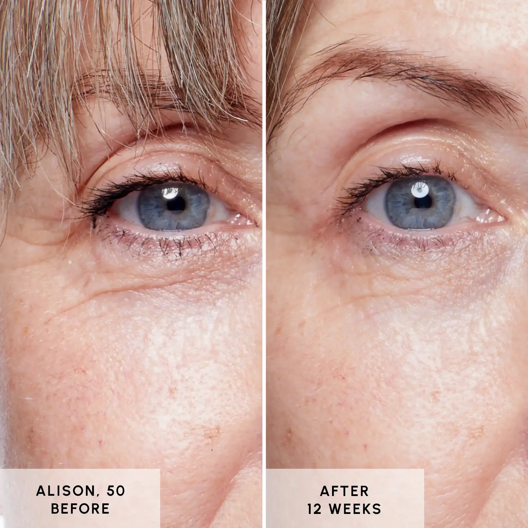 Glycan - Alison Before and After 01 Glycan - Alison Before and After 01