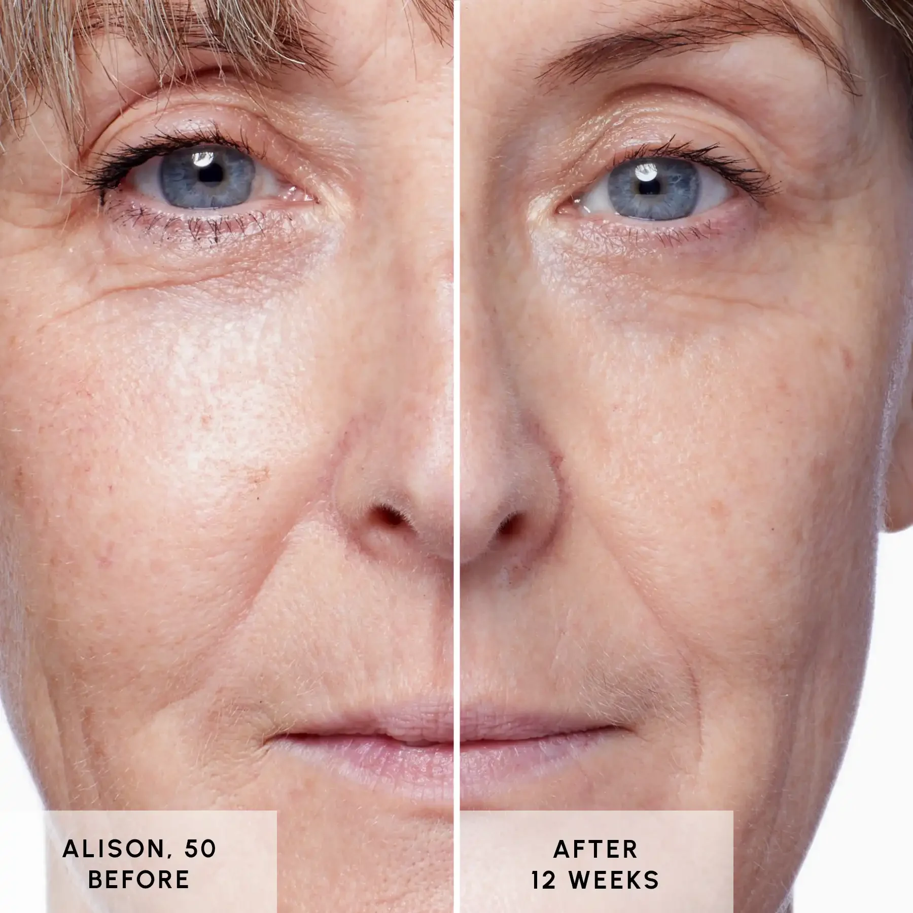 Glycan - Alison Before and After 02 Glycan - Alison Before and After 02