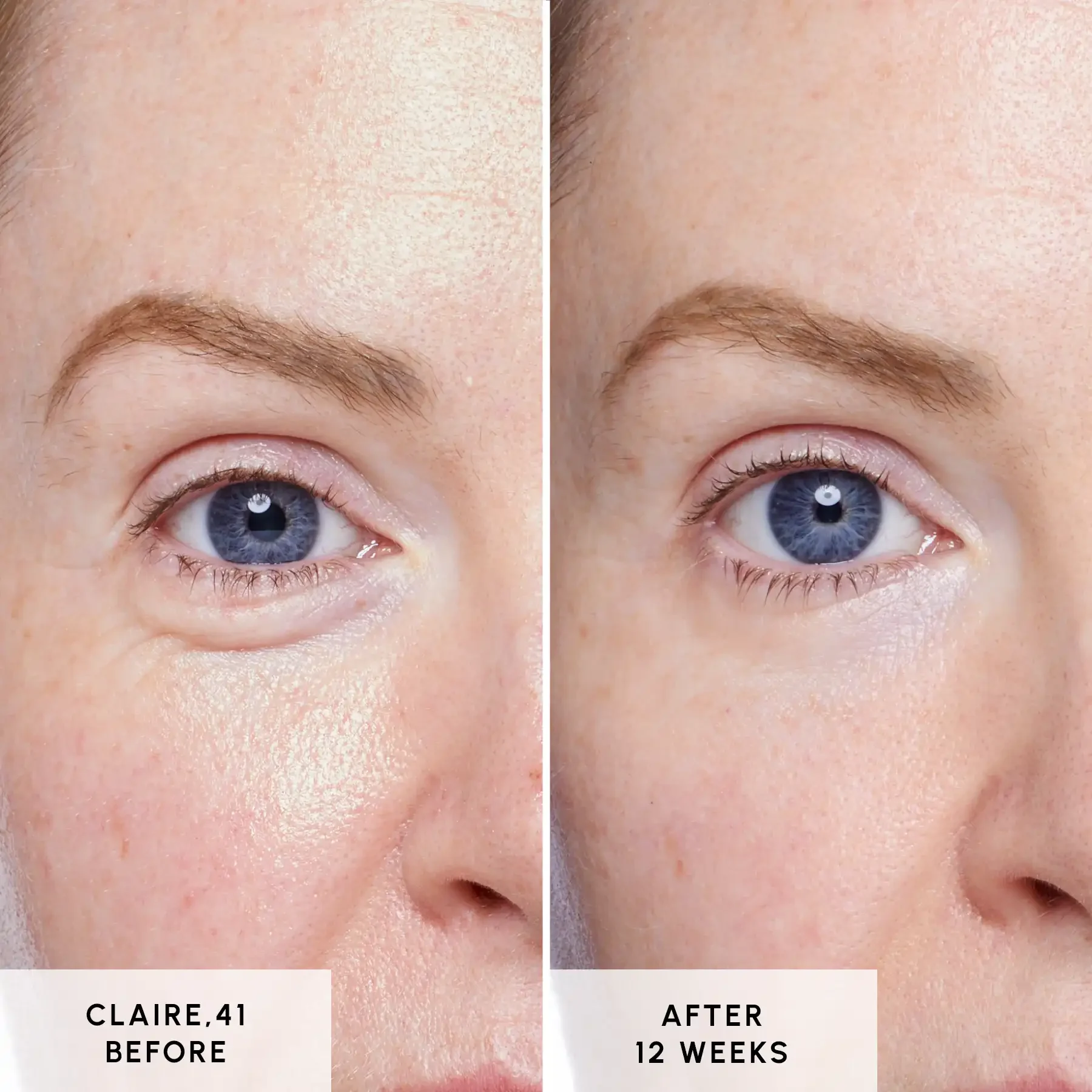 Glycan - Claire Before and After 01 Glycan - Claire Before and After 01