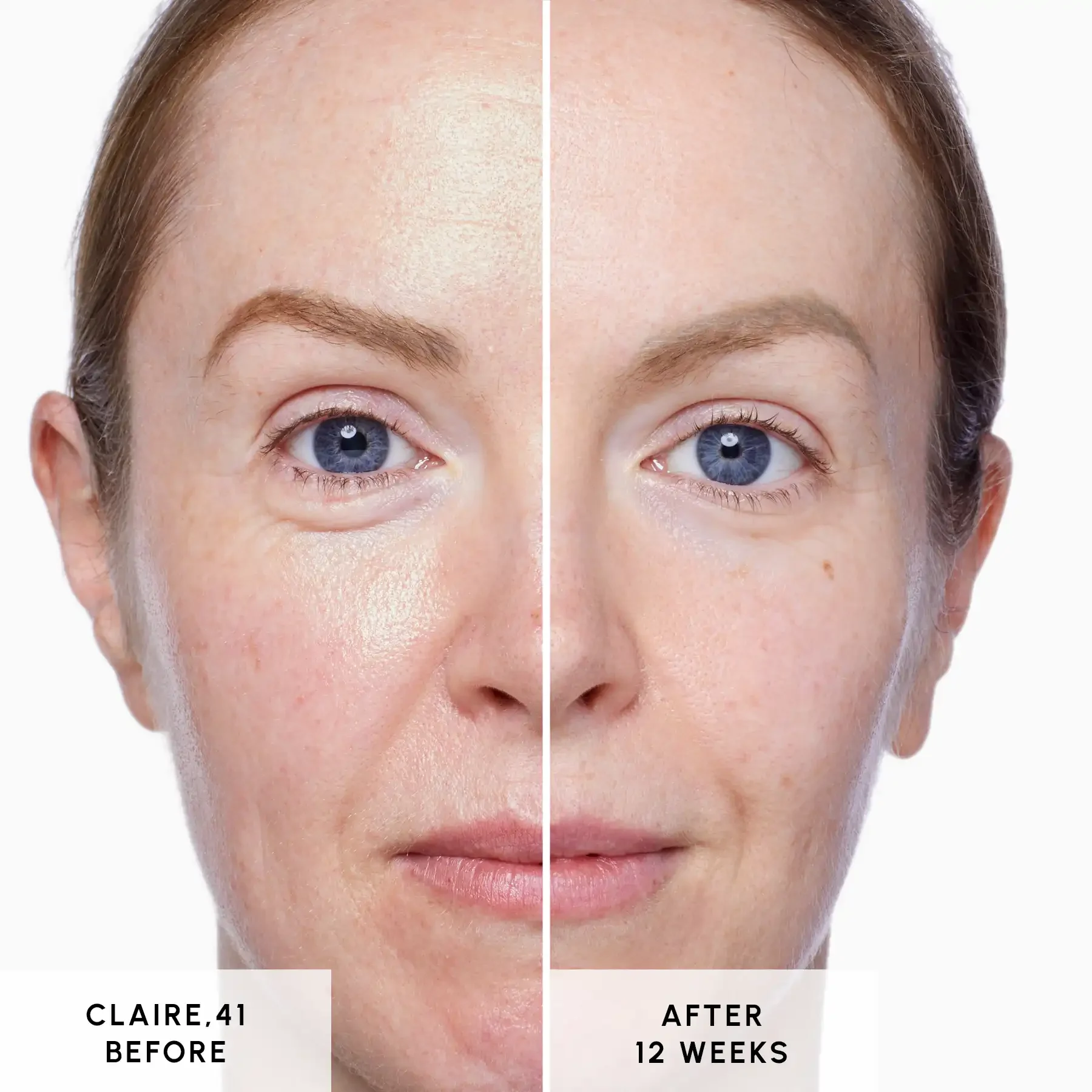 Glycan - Claire Before and After 02 Glycan - Claire Before and After 02