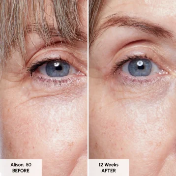 Seabody Glycan Enrich Moisturiser Before and After