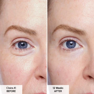 Seabody Glycan Enrich Moisturiser Before and After