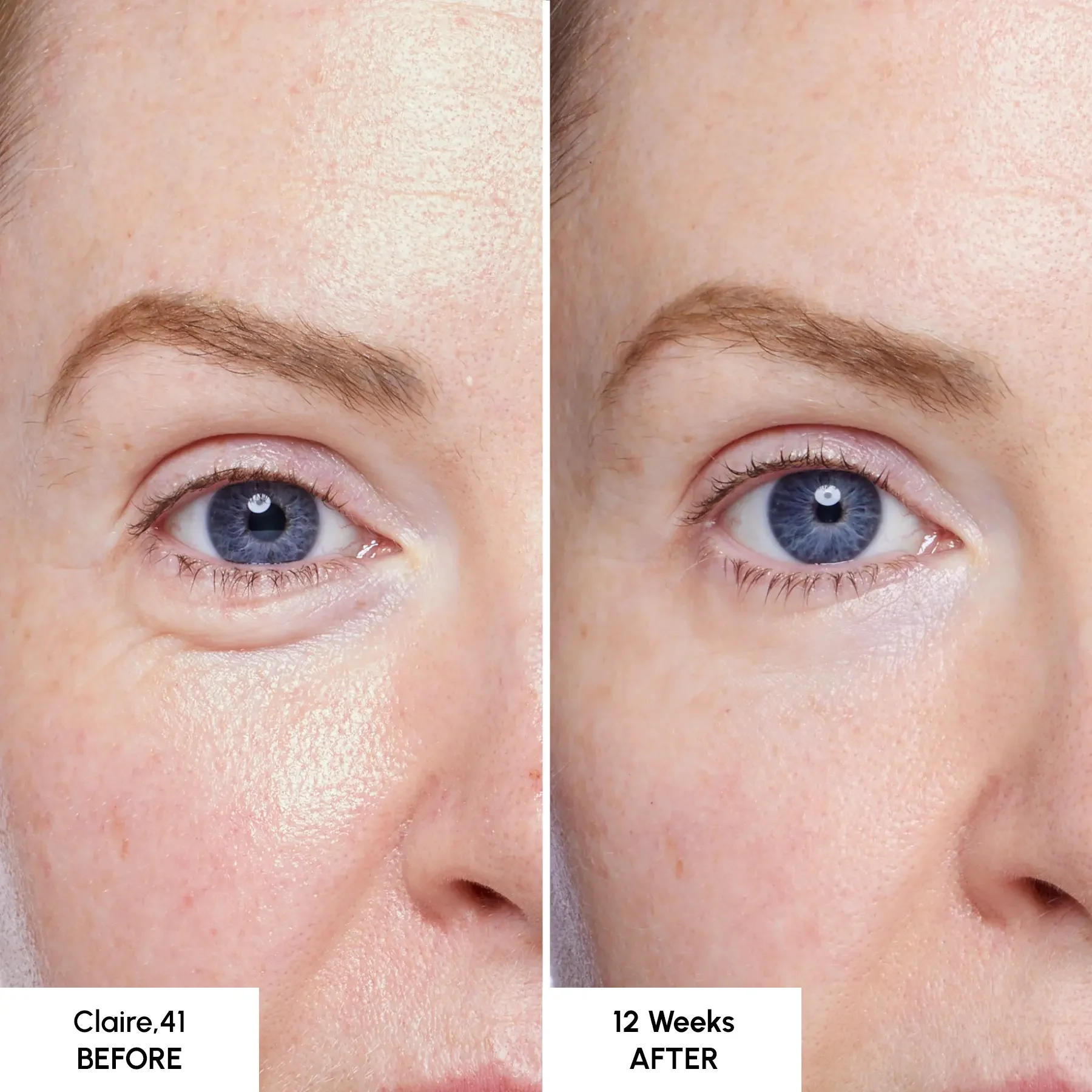 Glycan Product - B&A Claire Glycan Product - B&A Claire