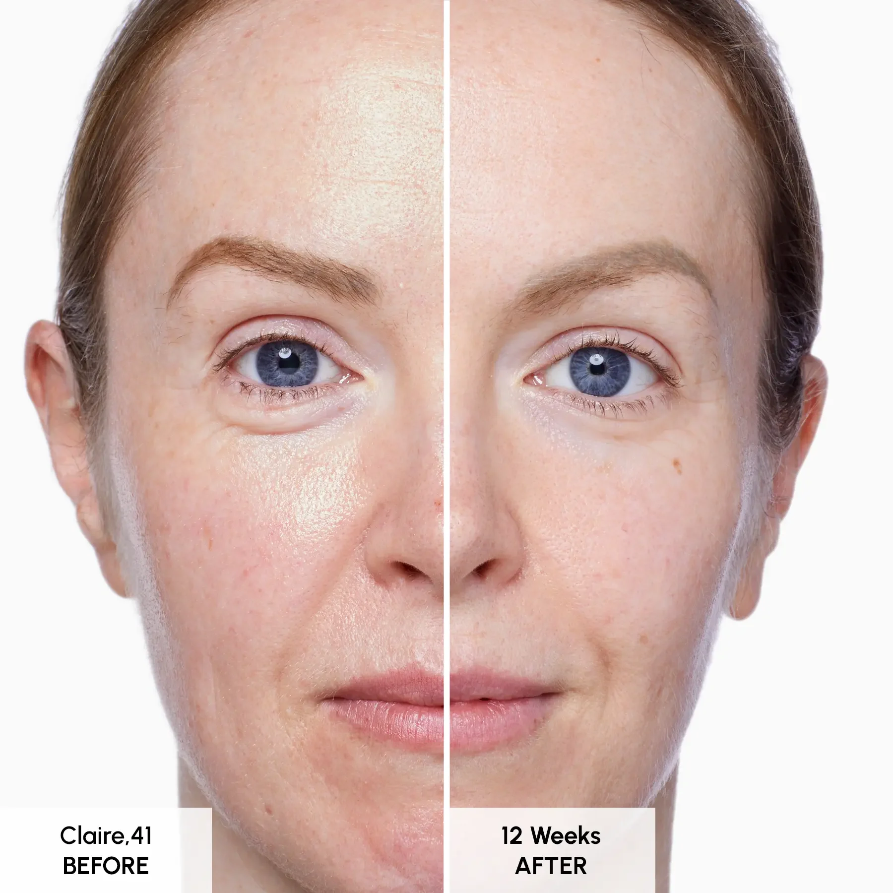 Seabody Glycan Enrich Moisturiser Seabody Glycan Enrich Moisturiser Before and After