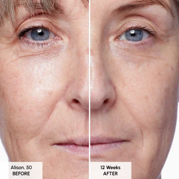 Seabody Glycan Enrich Moisturiser Before and After
