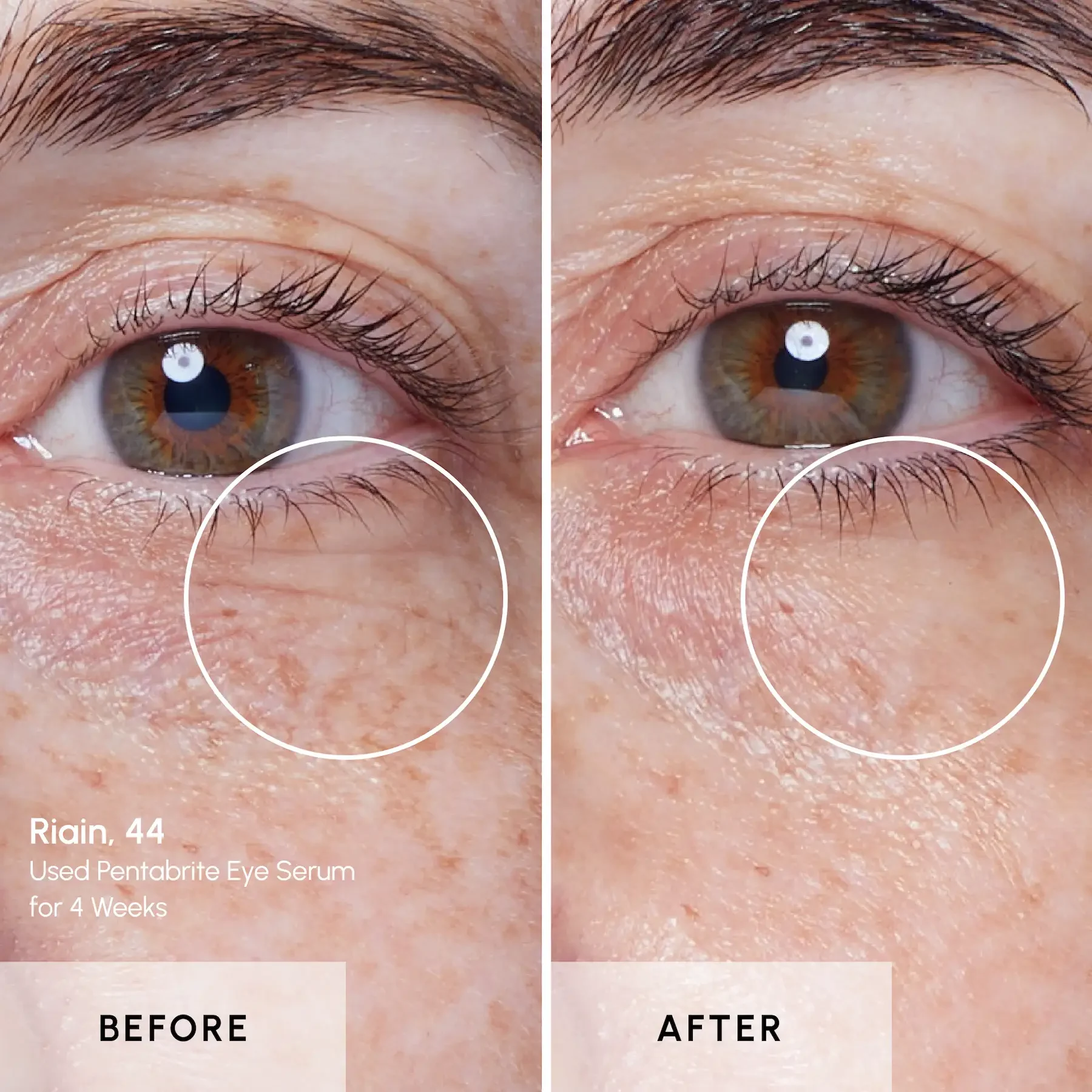 Pentabrite - Riains eye - Before and After Pentabrite - Riains eye - Before and After