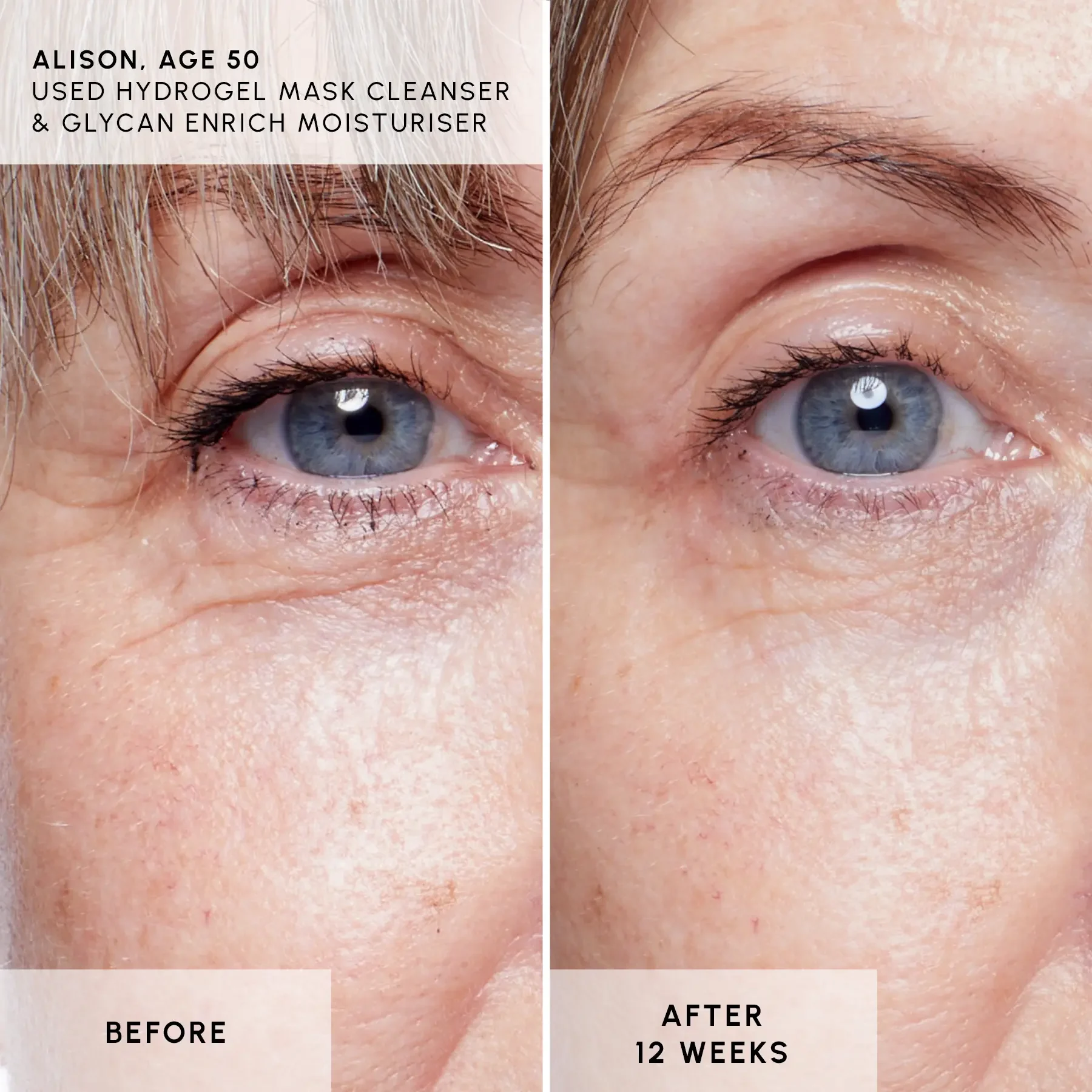 Bundle 1 - B&A 1 Bundle 1 - B&A 1