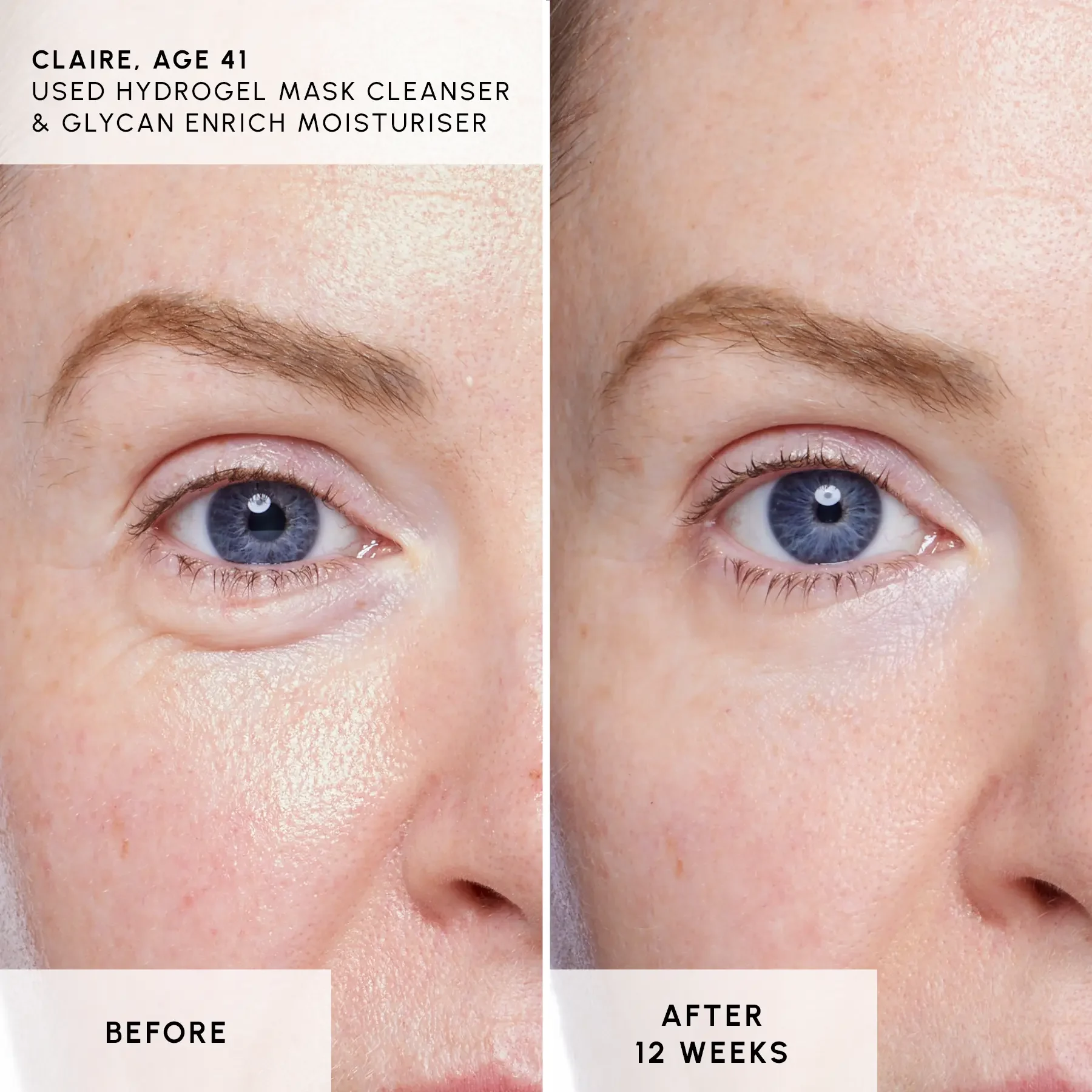 Bundle 1 - B&A 2 Bundle 1 - B&A 2