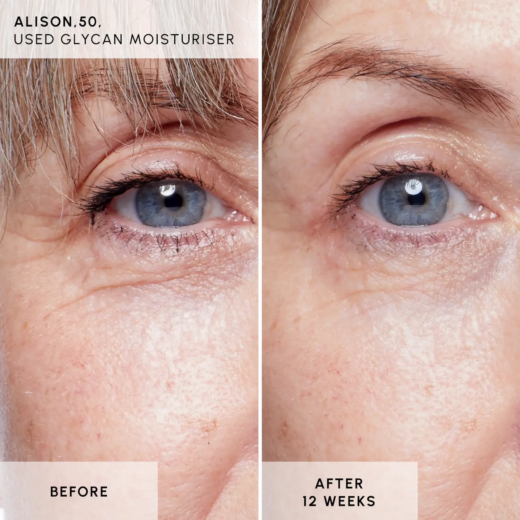 Alison B+A - Glycan Alison B+A - Glycan