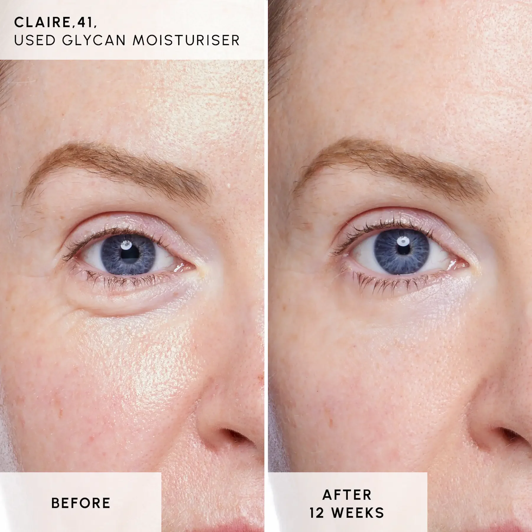 Claire B+A - Glycan Claire B+A - Glycan