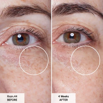 Seabody Pentabrite Eye Serum Before & After